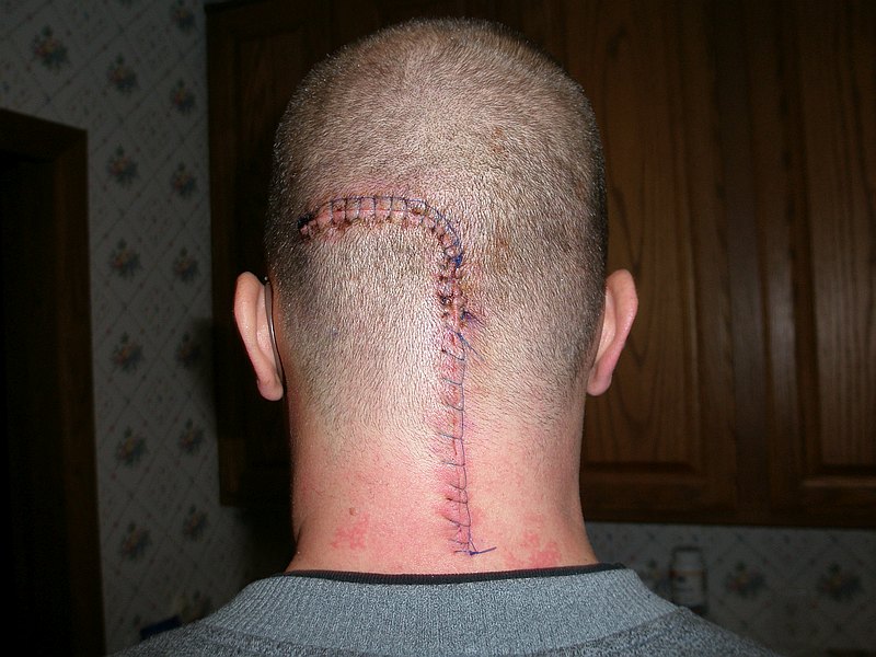 2012-12-01 Rodney Noll released from hospital